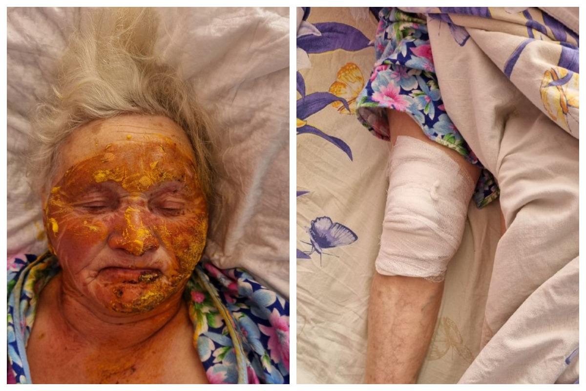 Фото Под Новосибирском опубликовали фото чудом выжившей при взрыве газа в доме пенсионерки 2